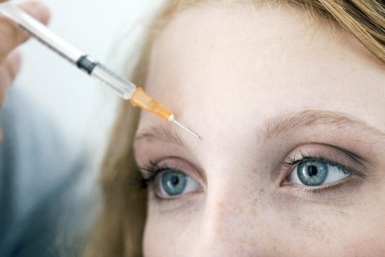 Die Injektion von Botox in definierte mimische Muskelgruppen