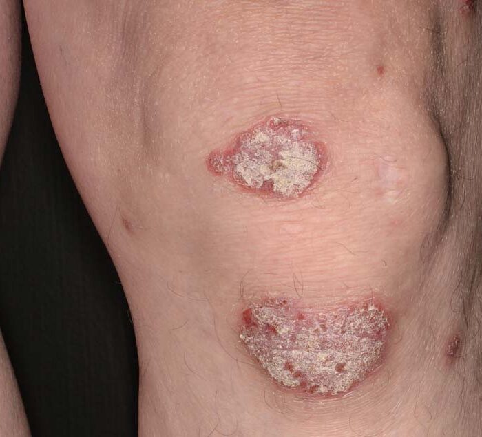 Dermatologie Hautarzt München PD Dr. med. Gerd Gauglitz