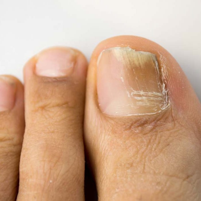 Dermatologie | Hautarzt München | PD Dr. med. Gerd Gauglitz